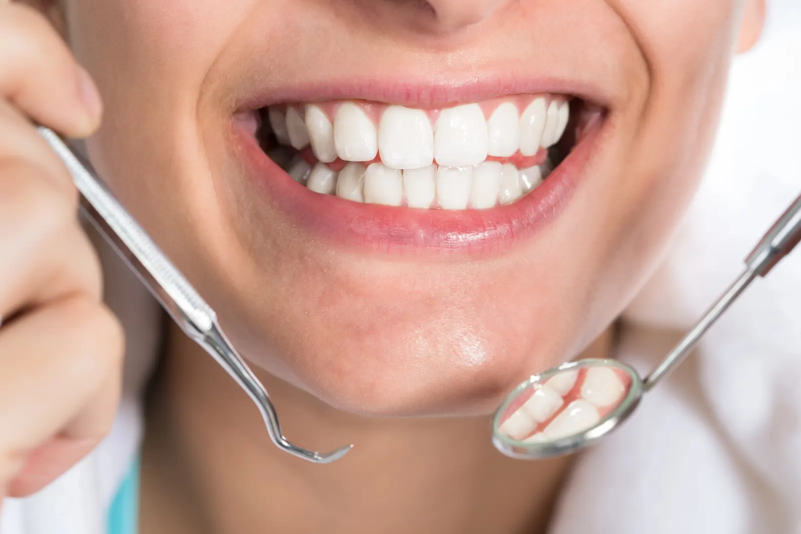 Close-up of a smiling mouth with white teeth and dental tools reflecting teeth.