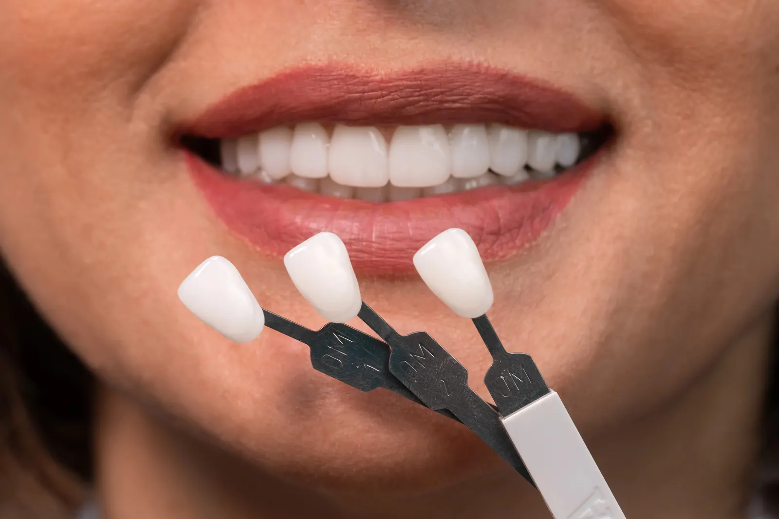Close-up of a woman smiling with dental shade guides held near her white teeth.