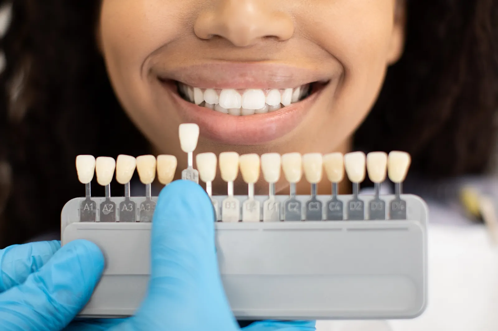Dentist matching dental veneer shade to a smiling woman's teeth for color accuracy.