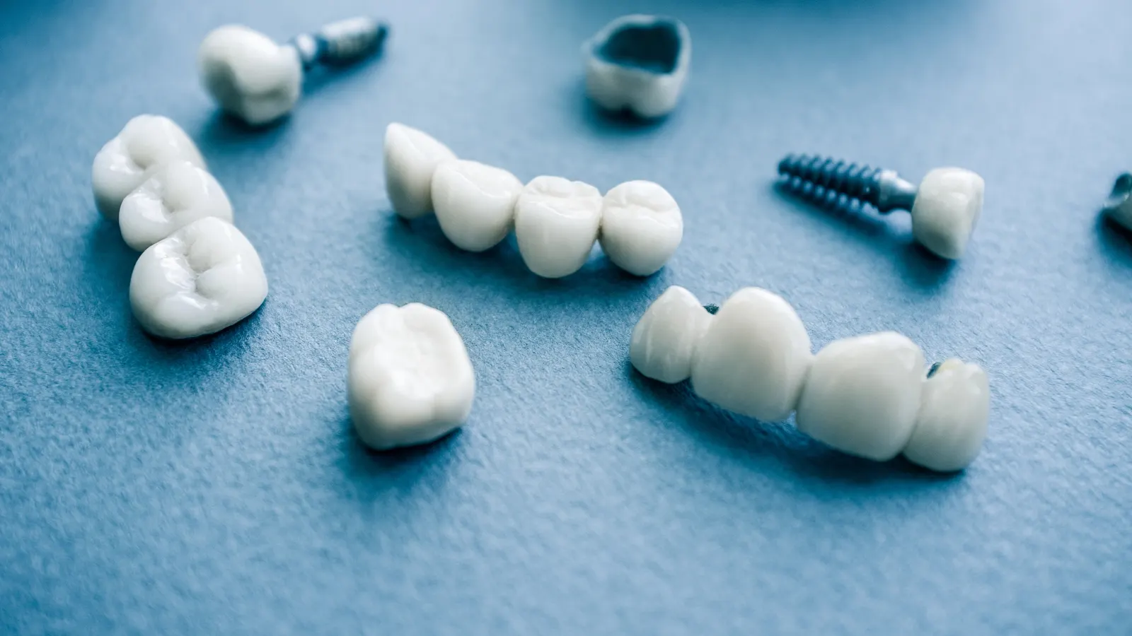 Various dental crowns and implants arranged on a blue surface.