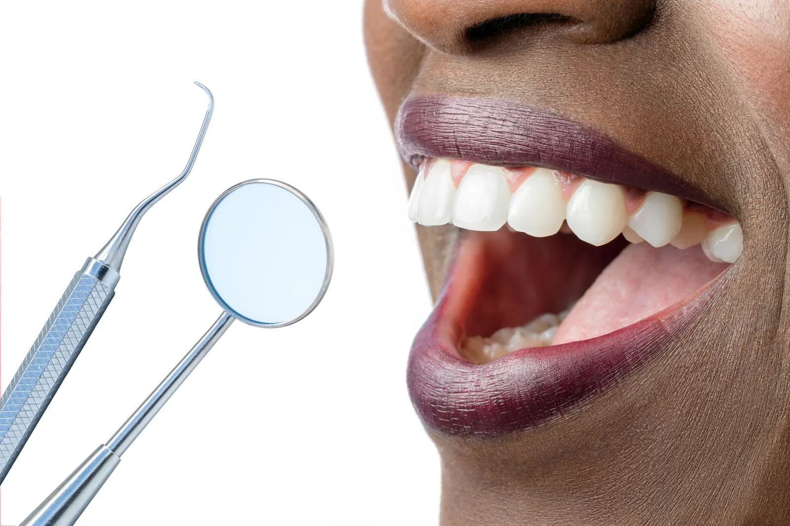 Close-up of open mouth with white teeth and dental tools, including a mirror and scaler.