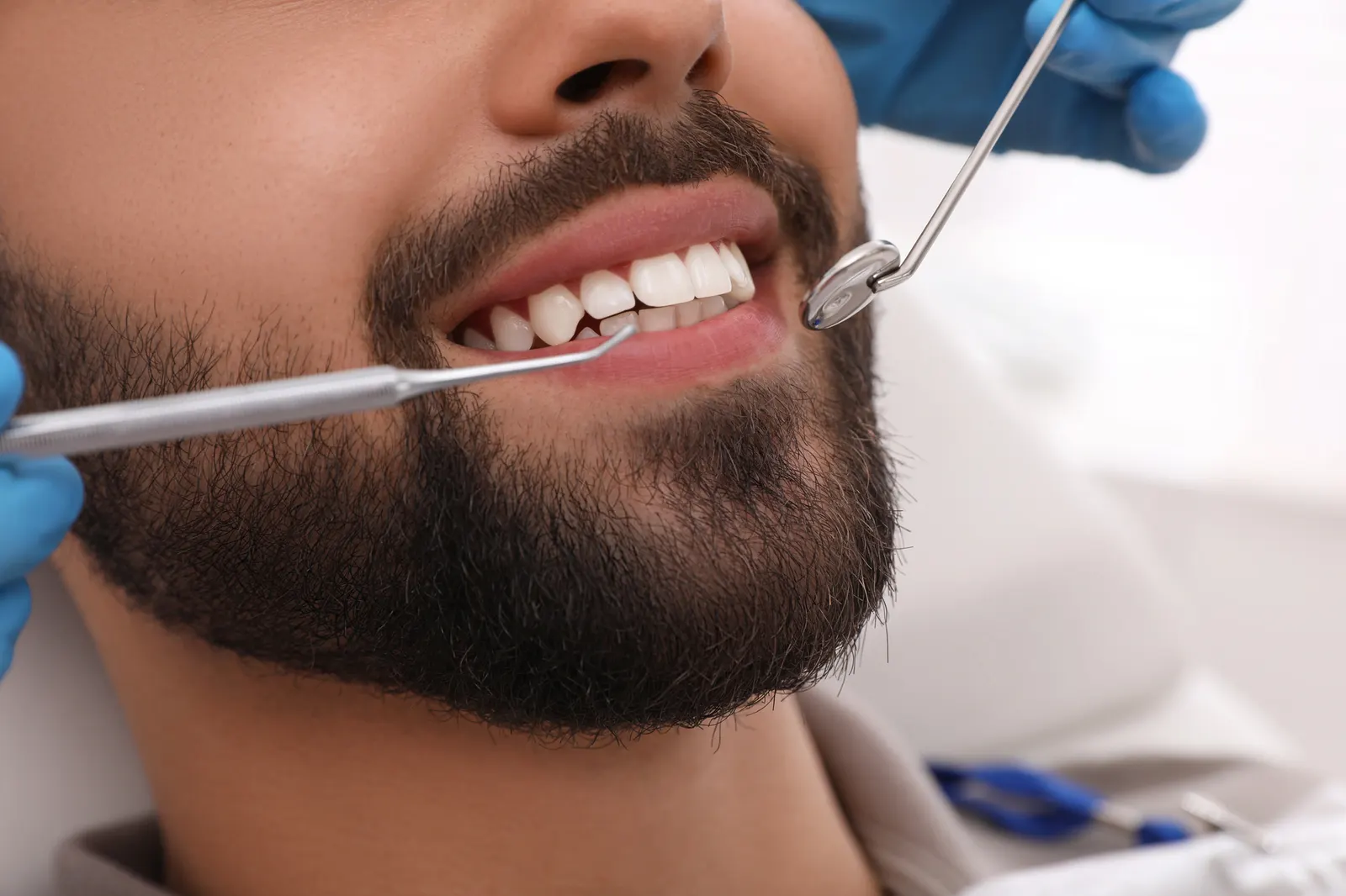 Close-up of a man smiling with dental tools near his teeth during a dental checkup.