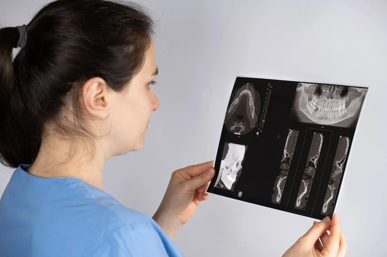 Medical professional in blue scrubs examining dental and jaw X-ray images on film.